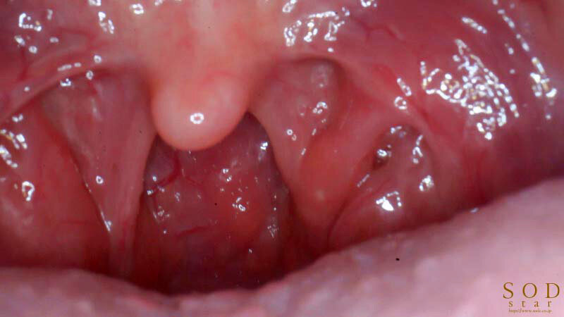 1START00193 サンプル11