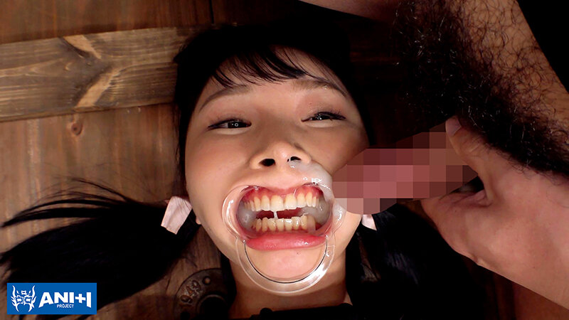 ANAV00006 サンプル12