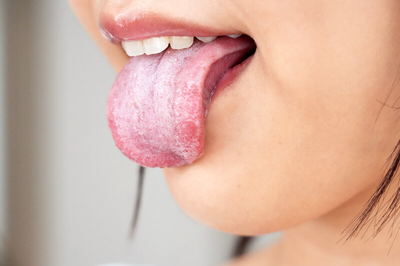 SAVR00596 サンプル9